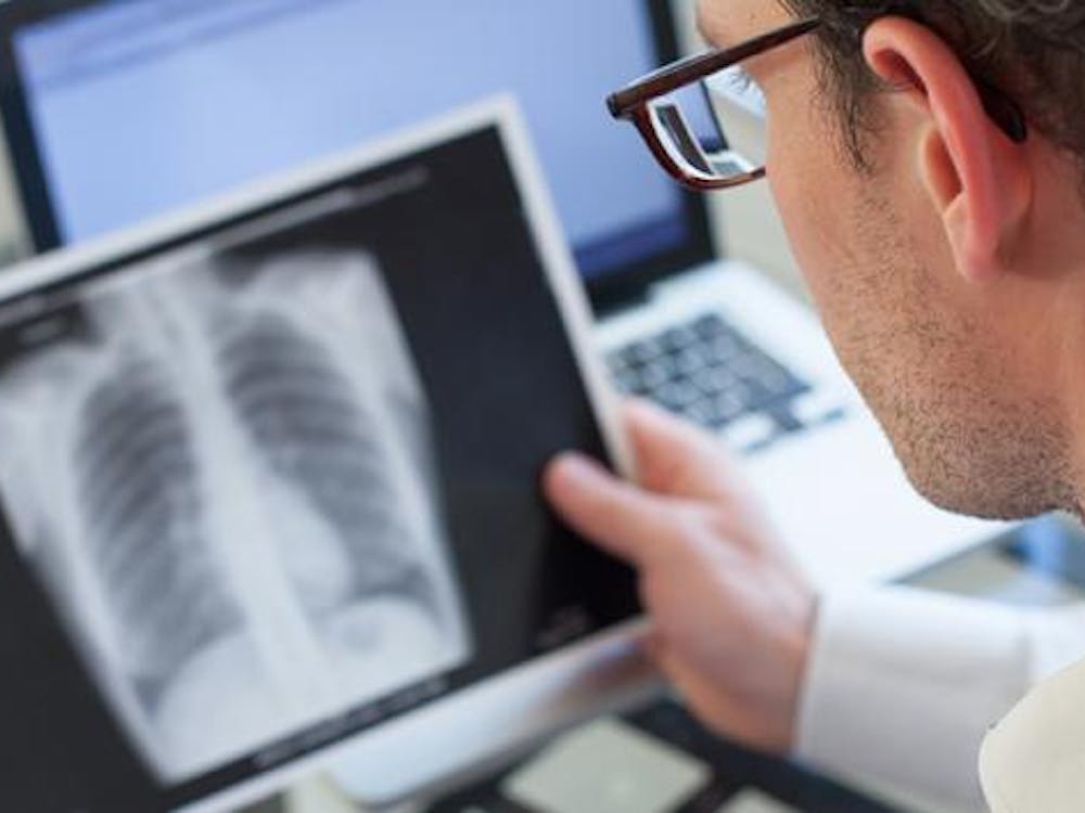 Looking at an x-ray of lungs for signs of TB