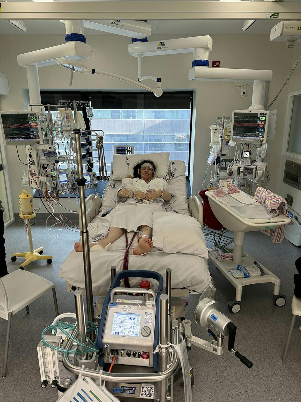 Alex on ECMO holding twins