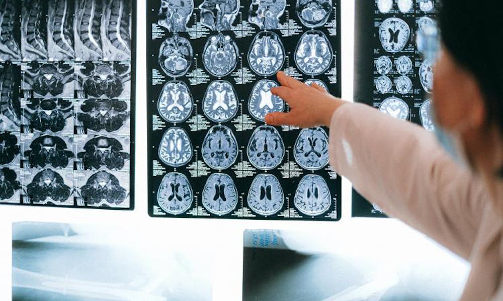 Staff looking at MRI results