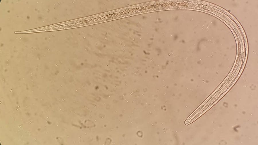 Microscopic view of strongyloidiasis