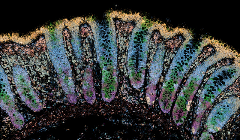 gut-tissue.jpg